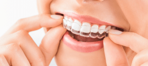 ortodonciainvisalign