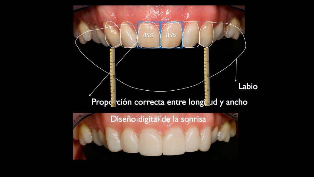 dsd dental marbella