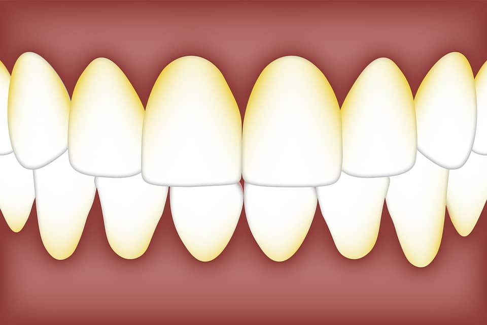 periodoncia Marbella