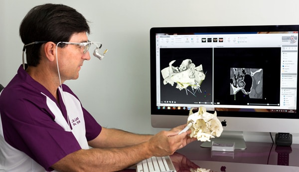 reconstruccion-dental-3d